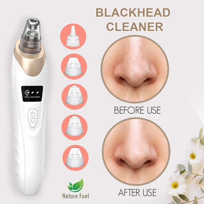 Blackhead Remover Vacuum | 5 Suction Levels, USB Rechargeable